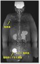 全身ＭＲＩ（DWIBS）がん検診利用券 1名様分