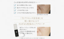 【ロゼべ】生プラセンタ&nbsp;美容液&nbsp;|京都&nbsp;コスメ&nbsp;美容液&nbsp;人気&nbsp;おすすめ［&nbsp;美容&nbsp;ブランド&nbsp;基礎化粧品&nbsp;スキンケア&nbsp;プラセンタ&nbsp;生原液&nbsp;&nbsp;大人のぽっかり毛穴&nbsp;原液&nbsp;原液美容液&nbsp;導入&nbsp;毛穴&nbsp;ゆるみ&nbsp;エイジングケア&nbsp;ギフト&nbsp;プレゼント&nbsp;お取り寄せ&nbsp;通販&nbsp;送料無料&nbsp;ふるさと納税&nbsp;］