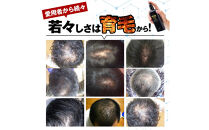 ポリピュアEX&nbsp;120ml&nbsp;医薬部外品&nbsp;薬用&nbsp;育毛剤&nbsp;男性用&nbsp;女性用&nbsp;育毛&nbsp;発毛&nbsp;促進&nbsp;薄毛&nbsp;抜け毛予防